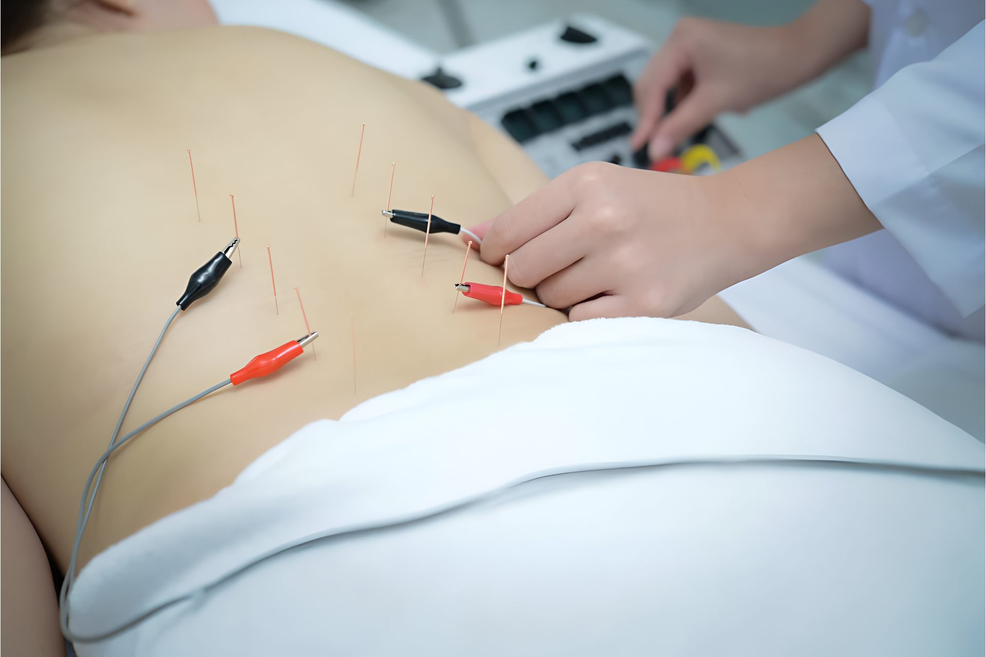 Electrotherapy for Slip Disc